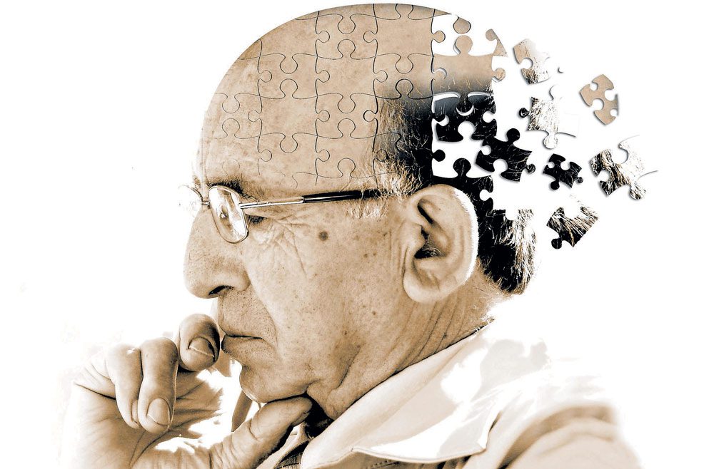 alzheimer- alzheimer-