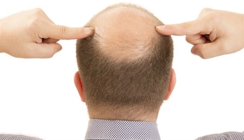 2025102712540398C7 2025102712540398C7