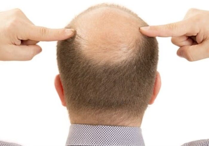 2025102712540398C7 2025102712540398C7